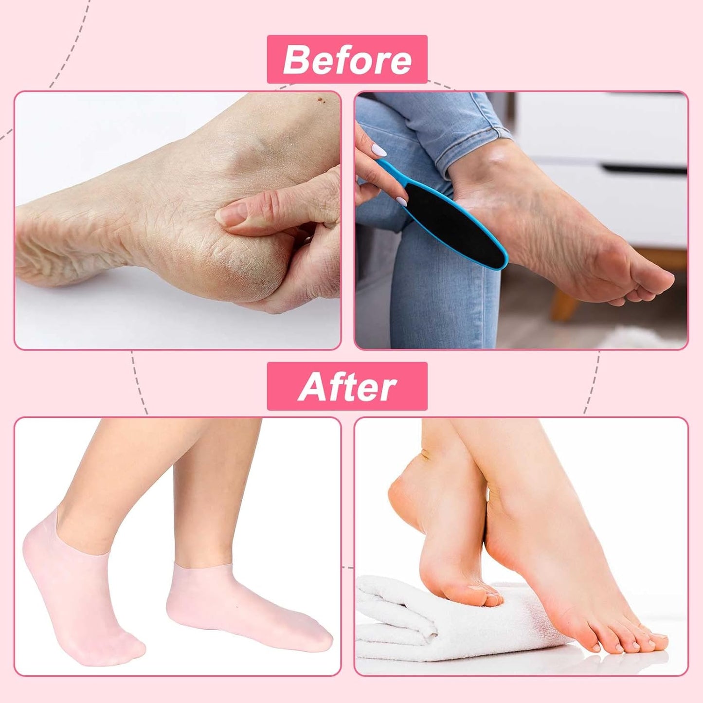 Moisturizing Silicone Socks